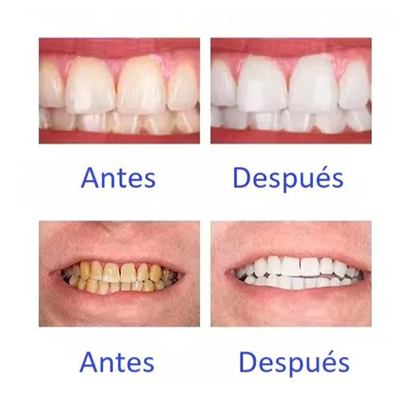 Sonrisa Radiante V34™